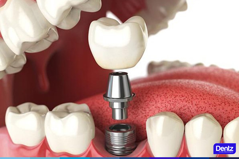 Dentz - Fachada Alphaville